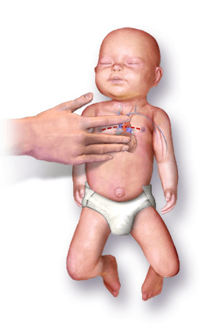 Infant CPR Training